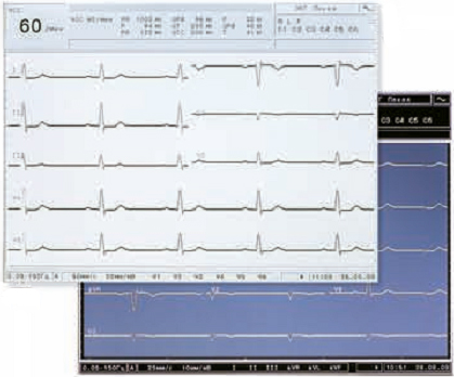 ������ ����������������� CARDIOVIT AT-10 plus � �������� �� �������